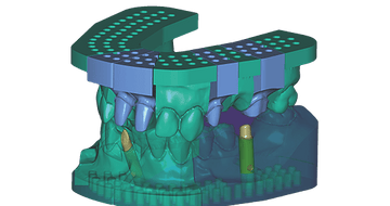 exocad Model Creator (Perpetual Initial Purchase)